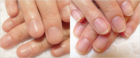 ビフォーアフター