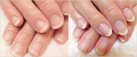 ビフォーアフター