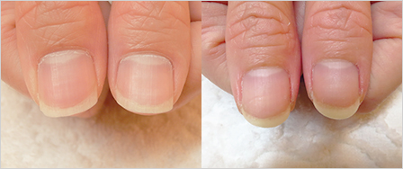 ビフォーアフター