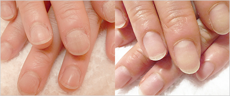 ビフォーアフター