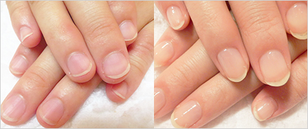 ビフォーアフター