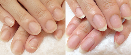 ビフォーアフター