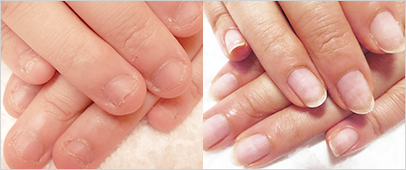 ビフォーアフター