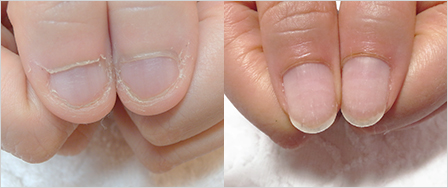 ビフォーアフター