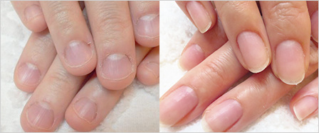 ビフォーアフター