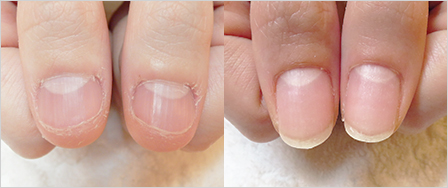 ビフォーアフター