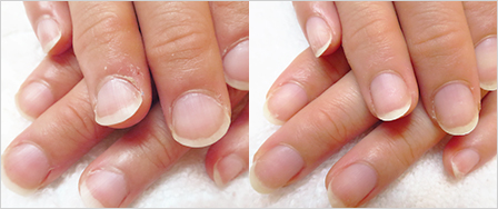 ビフォーアフター