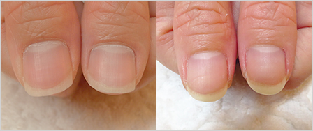 ビフォーアフター