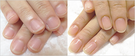 ビフォーアフター