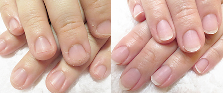 ビフォーアフター