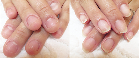 ビフォーアフター