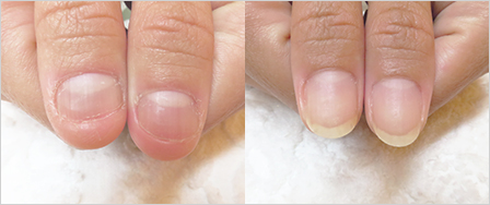 ビフォーアフター