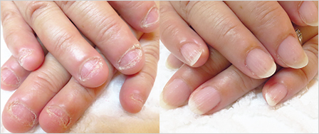 ビフォーアフター