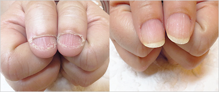 ビフォーアフター