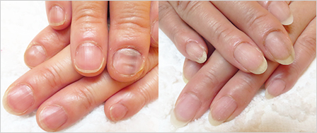 ビフォーアフター