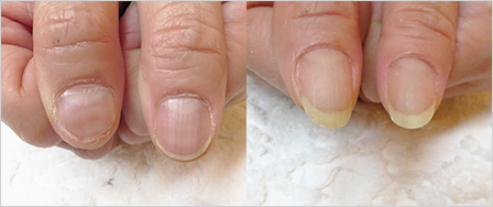 ビフォーアフター