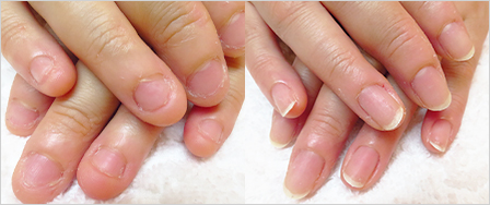 ビフォーアフター