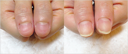 ビフォーアフター