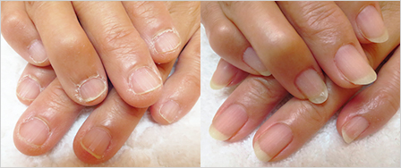 ビフォーアフター