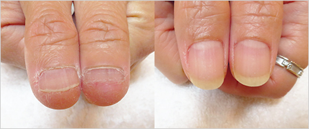 ビフォーアフター