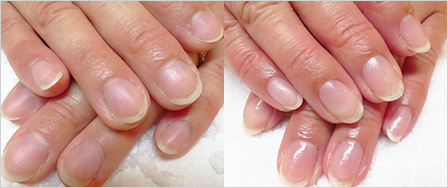 ビフォーアフター