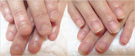 ビフォーアフター