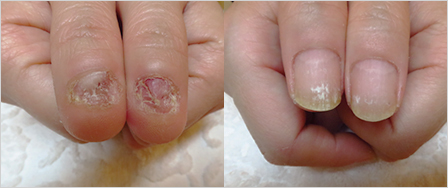 ビフォーアフター