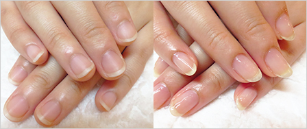 ビフォーアフター