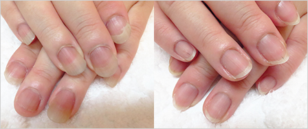 ビフォーアフター