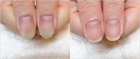 ビフォーアフター