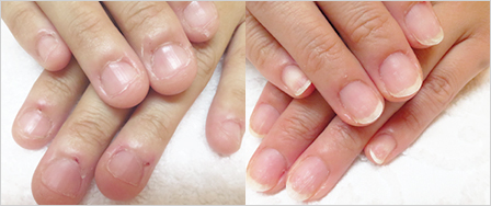 ビフォーアフター