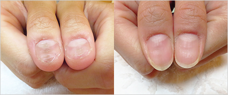 ビフォーアフター