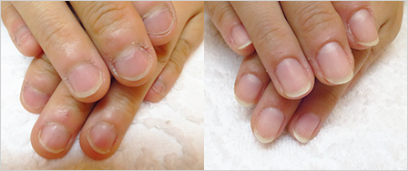 ビフォーアフター