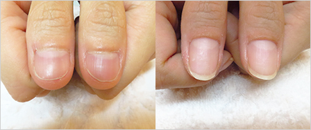 ビフォーアフター