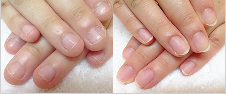 ビフォーアフター