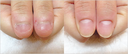 ビフォーアフター