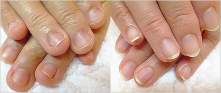 ビフォーアフター