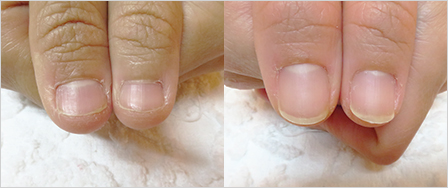 ビフォーアフター