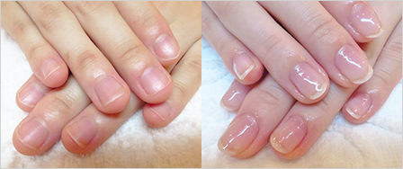 ビフォーアフター