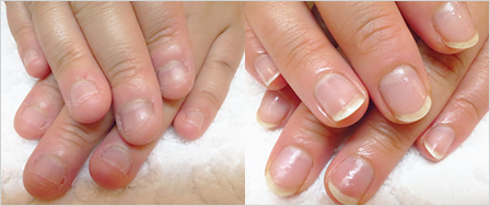 ビフォーアフター