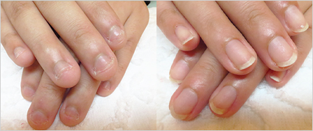 ビフォーアフター