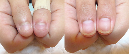 ビフォーアフター