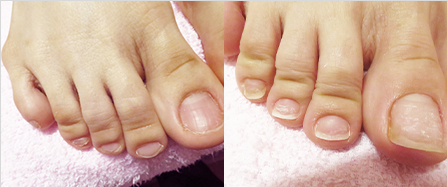 ビフォーアフター