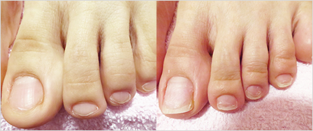 ビフォーアフター