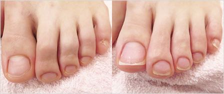 ビフォーアフター