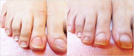 ビフォーアフター